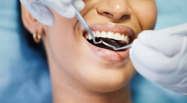Best Emergency Root Canal Treatment in Pratt, KS