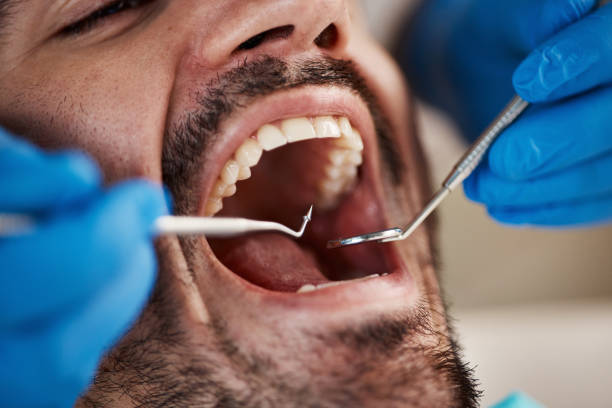 Best Emergency Treatment for Toothache in Pratt, KS